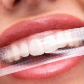 BestSeller Whitening Csomag