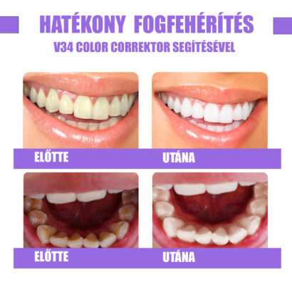 Fast Whitening Csomag - Image 11